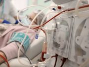 La malaltia renal crònica posa en alerta el sistema sanitari a Espanya